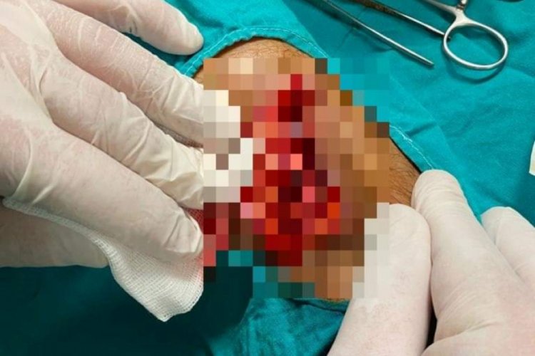 Bursa'da&nbsp;temizlik iş&ccedil;isi &ccedil;&ouml;p toplarken yaralandı, Başkan&nbsp;Taban tepki g&ouml;sterdi