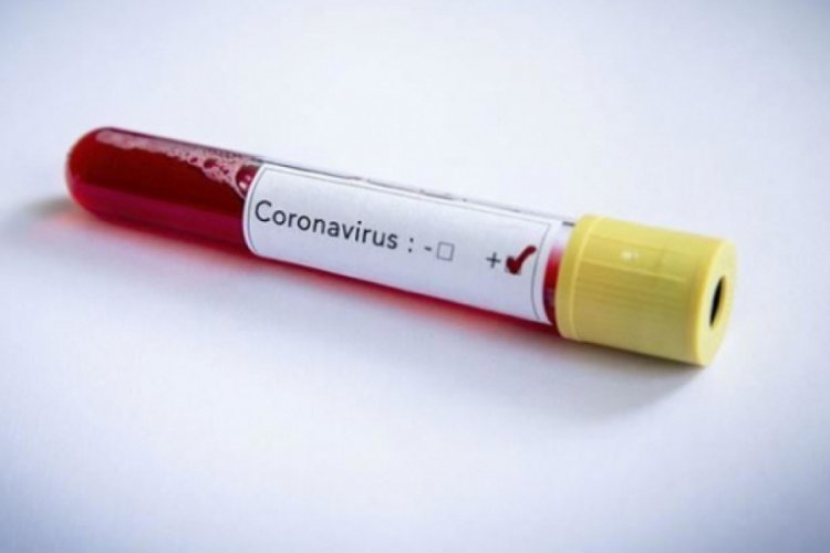Papua Yeni Gine'de koronavir&uuml;sten ilk can kaybı yaşandı