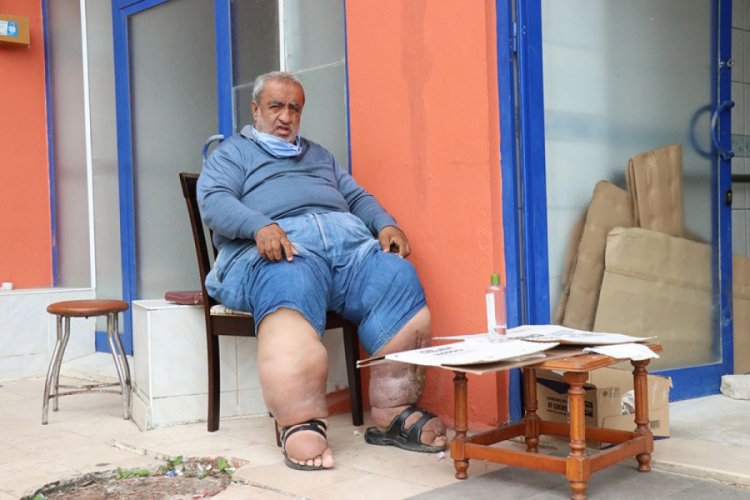 Fil hastası Necdet Candan tedavisi i&ccedil;in yardım istiyor
