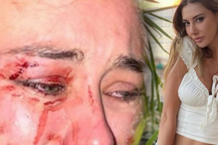 Daria'nın darp edildiği mekanın sahibi Şeyma'nın eski sevgilisi &ccedil;ıktı
