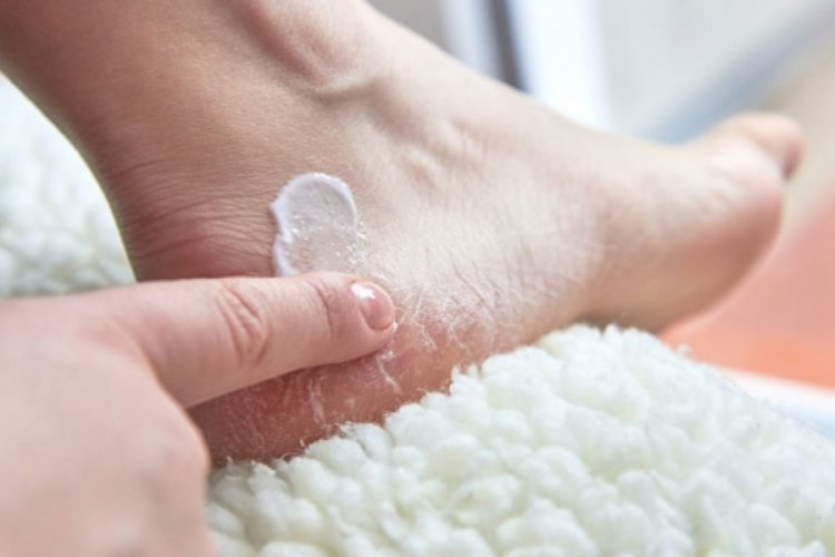 Hormonal bozukluk stres kırığına neden olabiliyor