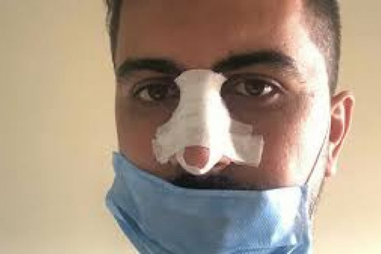Sosyal mesafe uyarısı yapan hemşirenin burnunu kırdılar