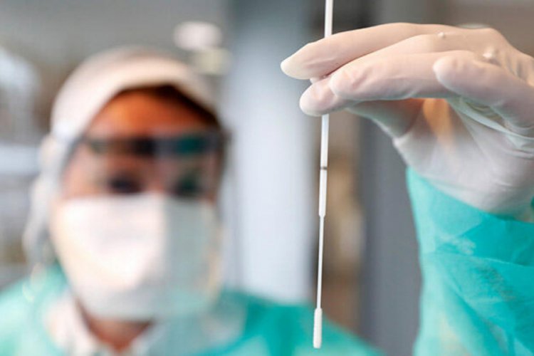 Azerbaycan'da son 24 saatte 124 yeni vaka