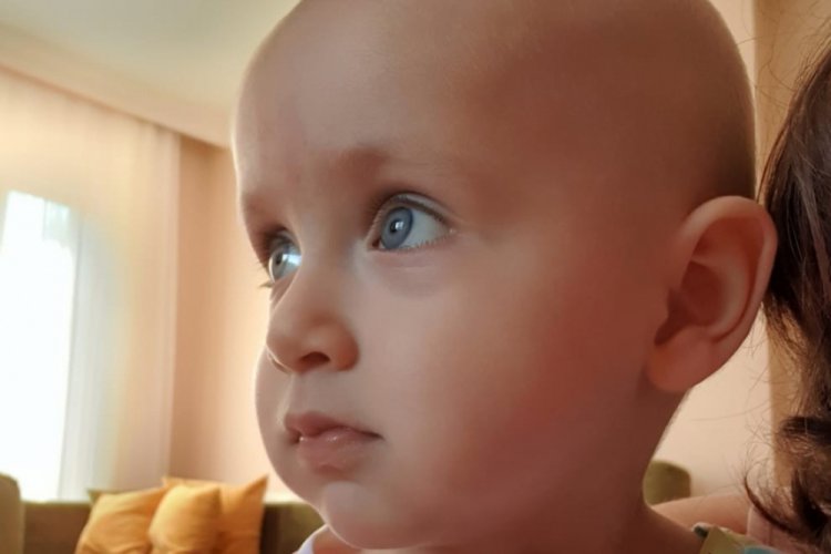 Duru bebek sağlığına kavuşmak i&ccedil;in yardım bekliyor