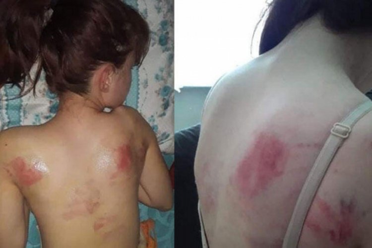14 yaşındaki kızını İngiliz anahtarıyla d&ouml;vd&uuml;!
