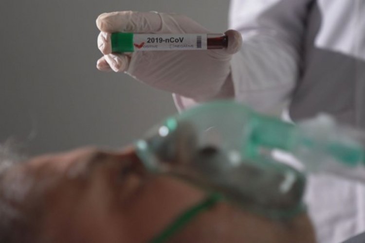 Potansiyel corona vir&uuml;s tedavisinde insanlı testlere başlandı