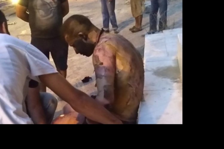 &Uuml;zerine tiner d&ouml;k&uuml;lerek yakıldığı ileri s&uuml;r&uuml;len kişi hayatını kaybetti