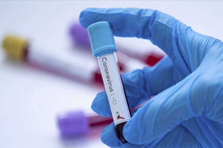 Gana'da Kovid-19 nedeniyle kapatılan havalimanları 5 ay sonra a&ccedil;ılıyor
