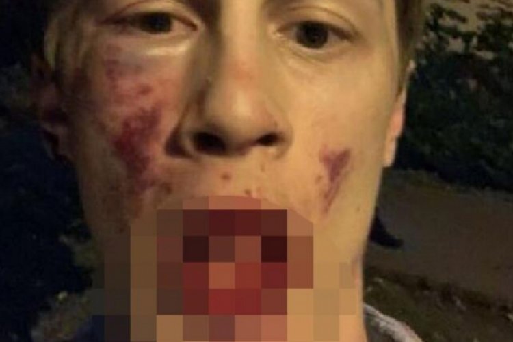 Rusya'da muhalif gazeteciye evinin &ouml;n&uuml;nde saldırıya uğradı