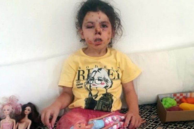 Balkonda oturan Neriman'ı bu hale getirdiler