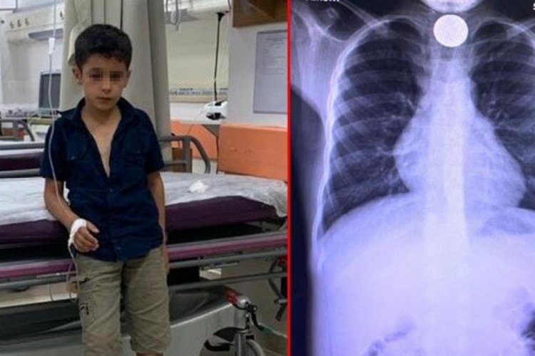 Madeni para yutan &ccedil;ocuk &ouml;l&uuml;mden d&ouml;nd&uuml;