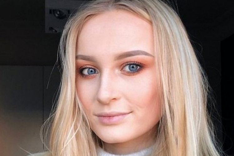 &Uuml;nl&uuml; model erkek arkadaşından g&ouml;rd&uuml;ğ&uuml; şiddeti fotoğraflarla belgeledi