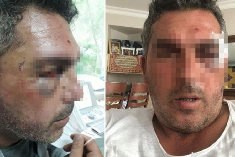 Kurye dehşeti! Motosikletle başını ezmeye &ccedil;alıştı