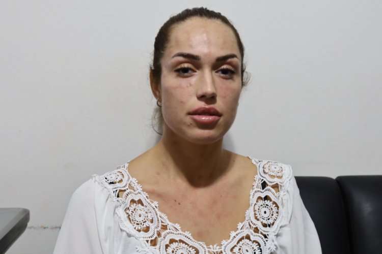 'Gen&ccedil;lik aşısı'nın ardından hastanelik olan Seline: Amacım y&uuml;z&uuml;m&uuml; nemlendirmekti