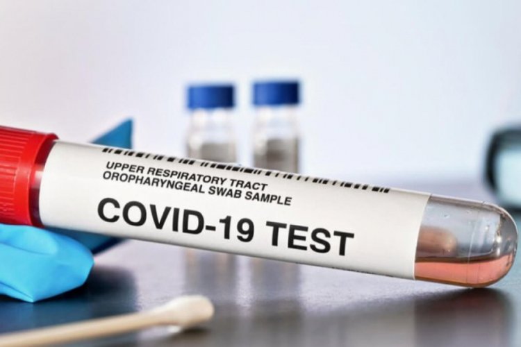 Sağlık Bakanlığı'ndan 'Covid-19 S&ouml;zl&uuml;ğ&uuml;'