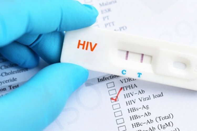 1 Aralık Dünya AIDS günü: Ülkemizde 26 bin 164 HIV tanısı alan hasta var