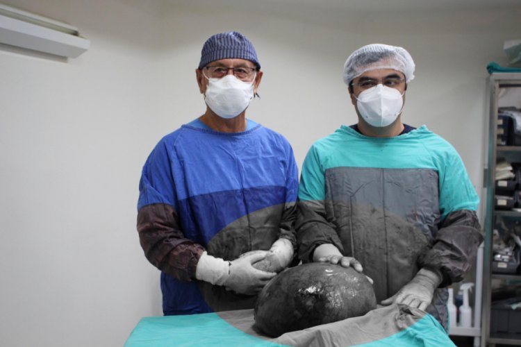 Gaz şikayetiyle gittiği hastanede karnından 9 kilo tümör çıkarıldı