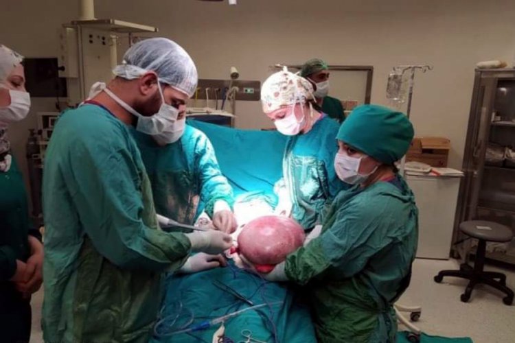 Karnından 9 kilo 800 gram kitle &ccedil;ıkarıldı