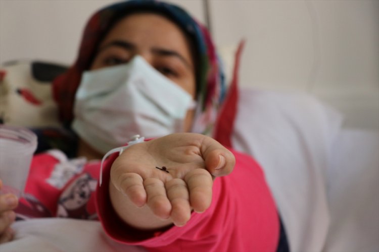 Bebekken yuttuğu toplu iğneden 17 yıl sonra kurtuldu