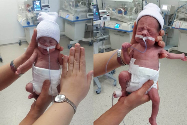 490 gram ve 680 gram doğan ikizler hayata tutundu