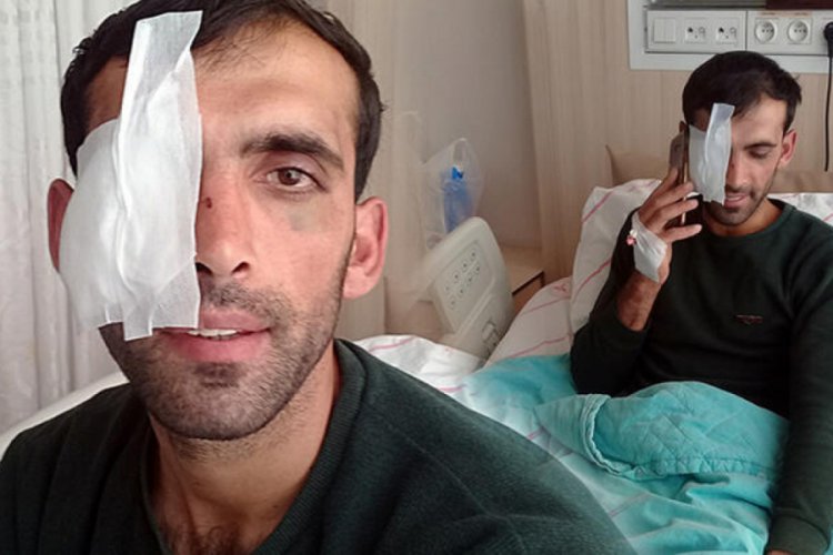 Atını ka&ccedil;ırarak işkence edenler tarafından d&ouml;v&uuml;ld&uuml;