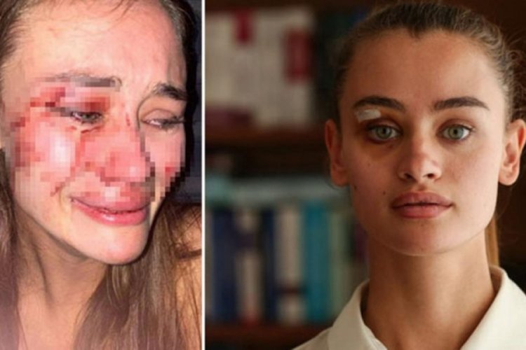 &Ccedil;eşme'deki darp olayıyla g&uuml;ndem olmuştu! Ukraynalı top model şikayetinden vazge&ccedil;ti