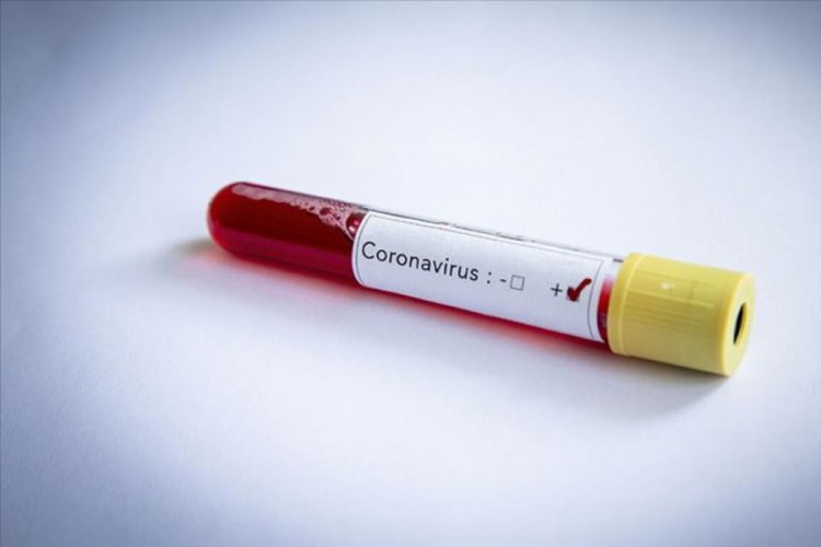 ABD'de koronavirüs ölümleri 346 bin 603'e yükseldi