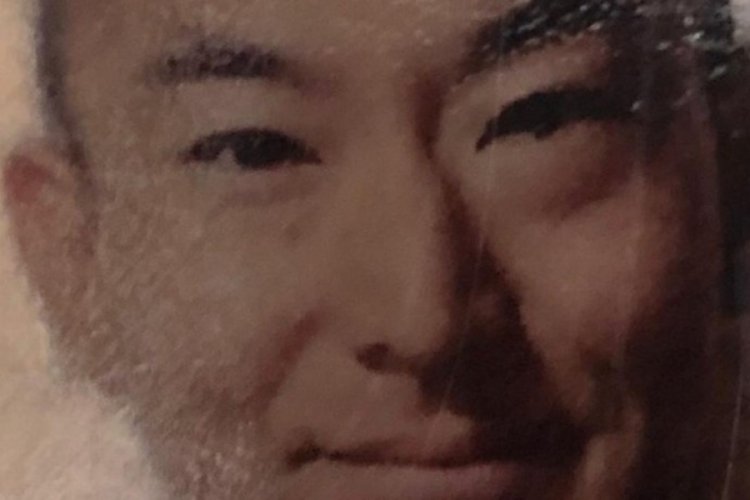 Japon turist saç ekimi sonrası öldü