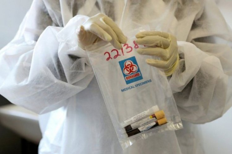 Rusya'da son 24 saatte 24 bin 763 yeni koronavirüs vakası