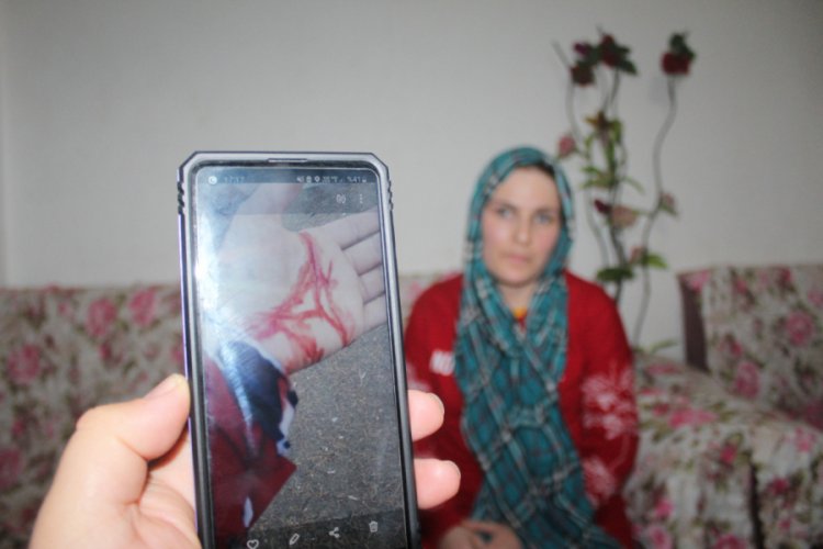 Eski eşinin yaşattığı dehşeti anlattı, saatler sonra morga gidip cesedini teşhis etti