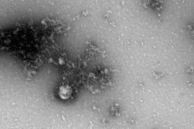 Koronavirüs mutasyonunun fotoğrafı çekildi