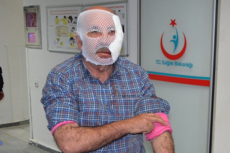 &Ccedil;ocuklarını kurtardı, y&uuml;z&uuml; par&ccedil;alandı