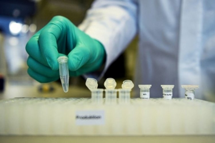 İlaç devi 160 milyon doz CureVac aşısı üretecek - Dünyadan ...