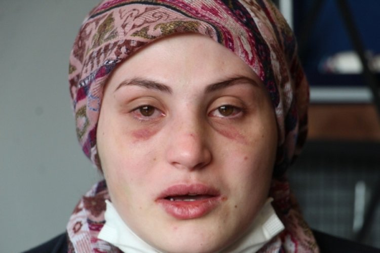 Ka&ccedil;arak evlendiği eşi gen&ccedil; kadına kabusu yaşattı