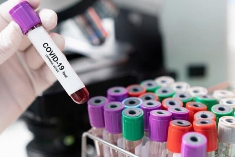 Almanya'da eğlence sekt&ouml;r&uuml;nde koronavir&uuml;s testi teklifi