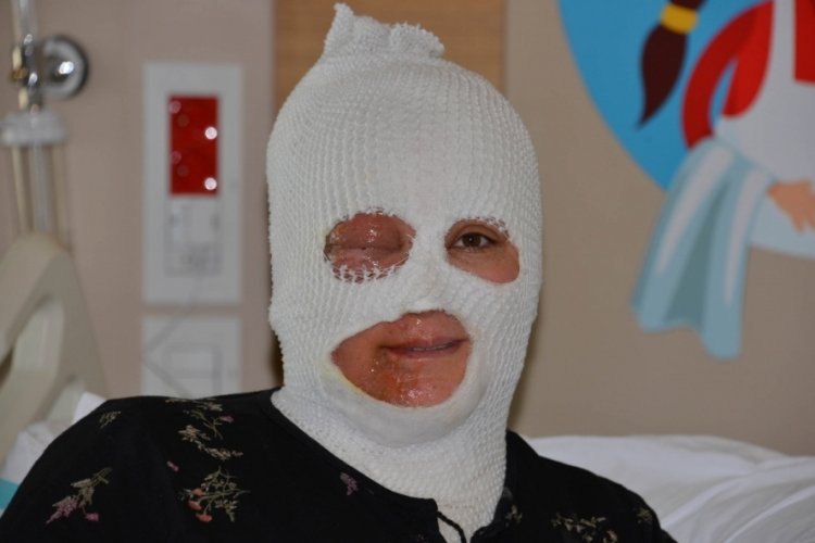 Demlediği &ccedil;ay &uuml;st&uuml;ne d&ouml;k&uuml;len kadın ağır yaralandı
