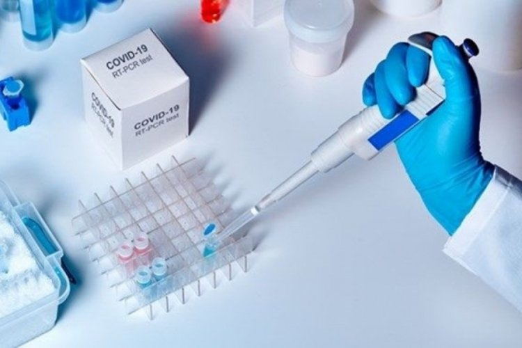 D&uuml;nyada ilk: 90 kişi kendi isteğiyle koronavir&uuml;s olacak