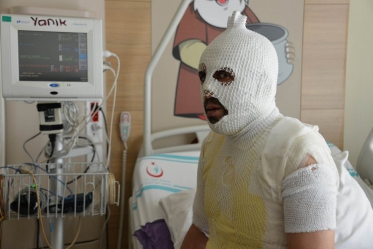 Haşlanmış olarak hastaneye geldi: Beni yaktılar