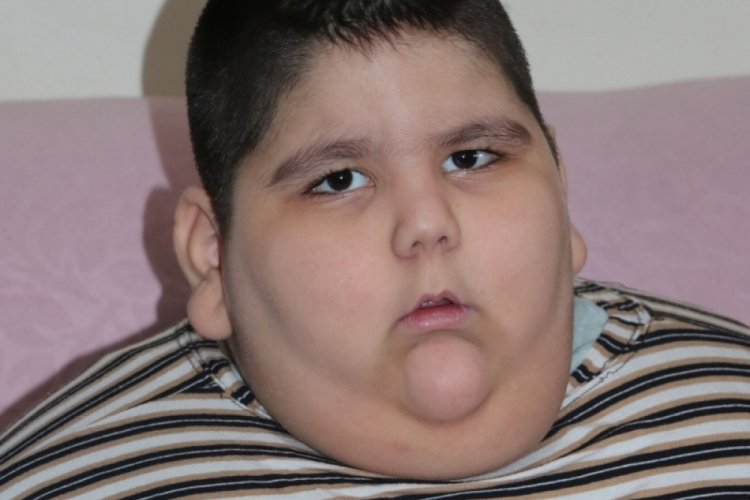 5 yaşında 90 kiloya ulaştı