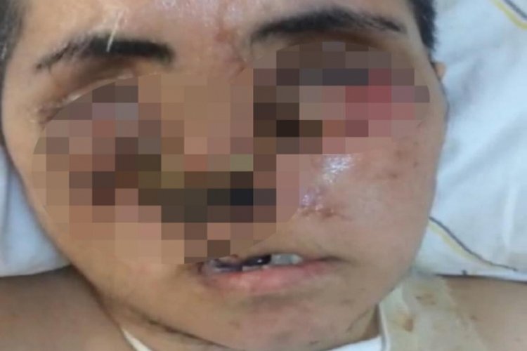 Eniştesinin saldırısı sonucu ağır yaralandı, y&uuml;z&uuml; tanınmayacak hale geldi