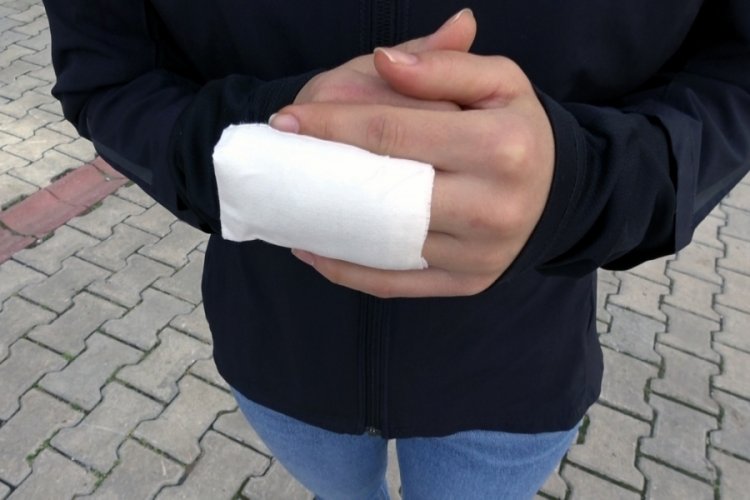 Parmakları ısırılan B&uuml;şranur: Ucuz atlattım, parmağımdan olabilirdim