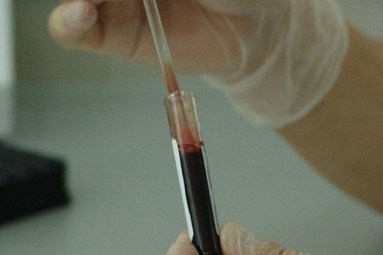 Kanser h&uuml;creleri uyku haline ge&ccedil;erek kemoterapiden ka&ccedil;abilir