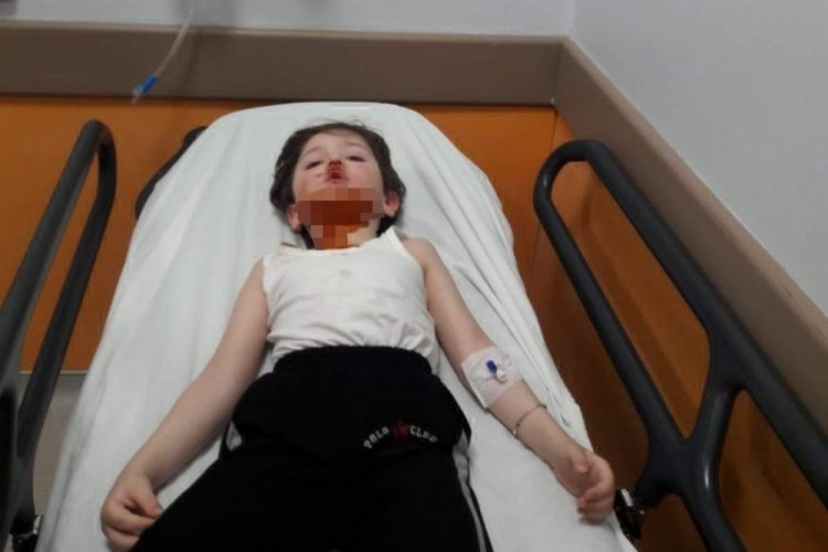 K&uuml;&ccedil;&uuml;k Bedirhan, sokak k&ouml;peklerinin saldırısında yaralandı