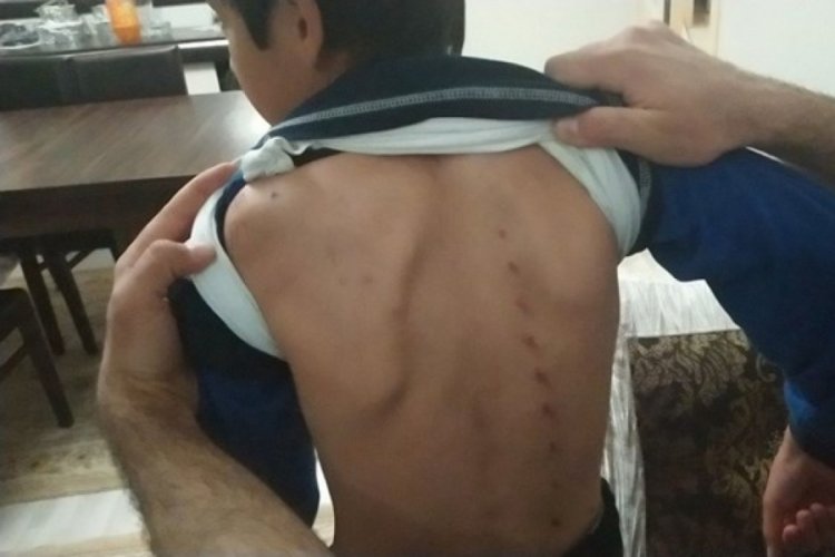 &Ccedil;ocuklara tırnakla yaralayan kadın tutuklandı