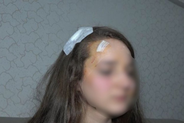 Bursa'da genç kız, tanımadığı kişi tarafından sokak ortasında 'Muşta' ile darp edildi