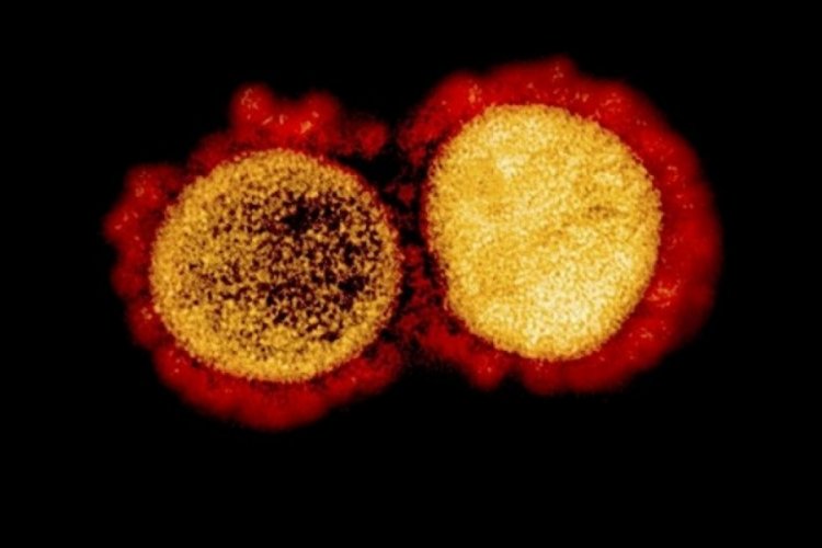 'Çift mutant' corona virüs varyantı ABD'ye sıçradı