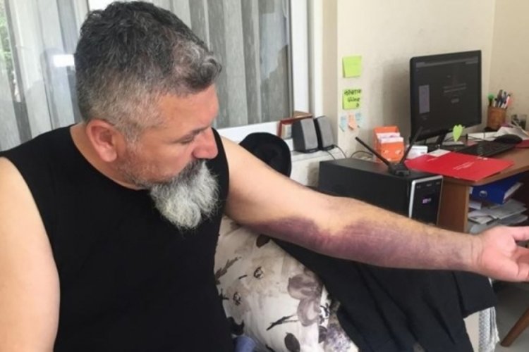 Esrarengiz kazanın ardından öldüresiye dövüldü
