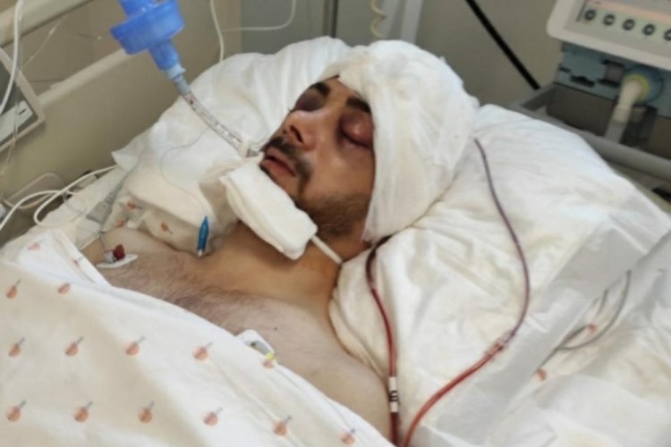 Attan d&uuml;şen jokeyin yaşam m&uuml;cadelesi s&uuml;r&uuml;yor