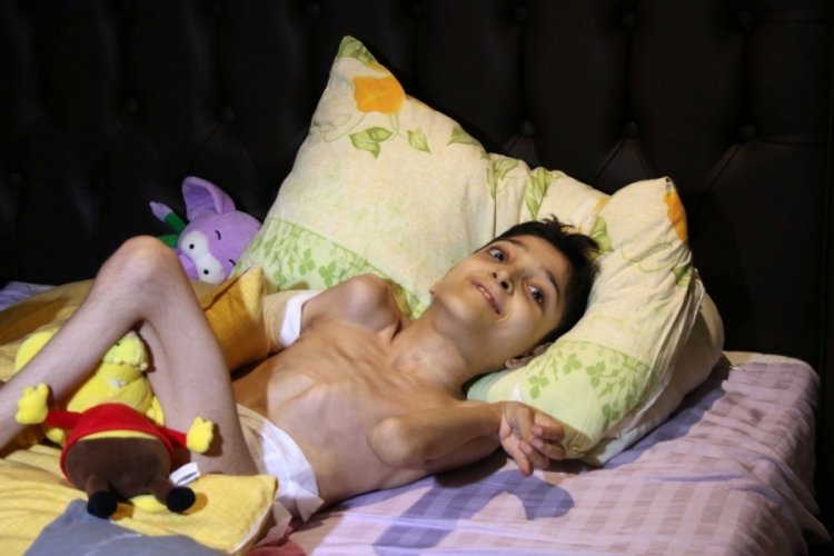 Cam kemik hastası oğlu ayağa kalksın diye 10 yıldır m&uuml;cadele ediyor