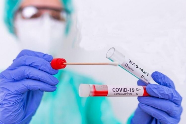 Koronavir&uuml;s&uuml; 1 dakikada tespit eden "&uuml;flemeli" teste onay